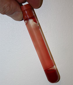 Blood clotting times performed in test tube